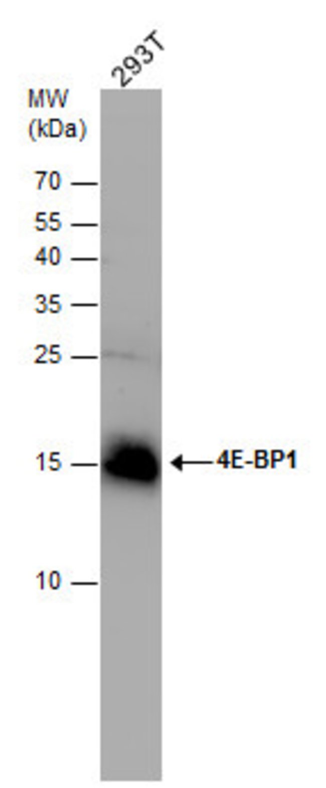 ANTI-EIF4EBP1