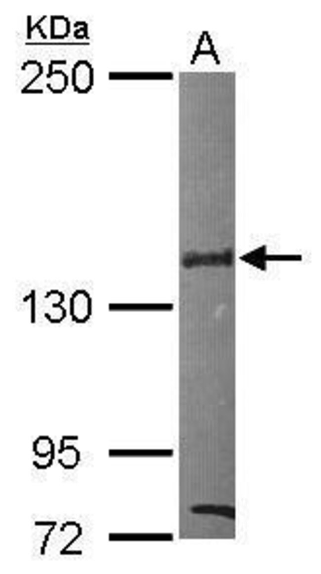 ANTI-SIN3B