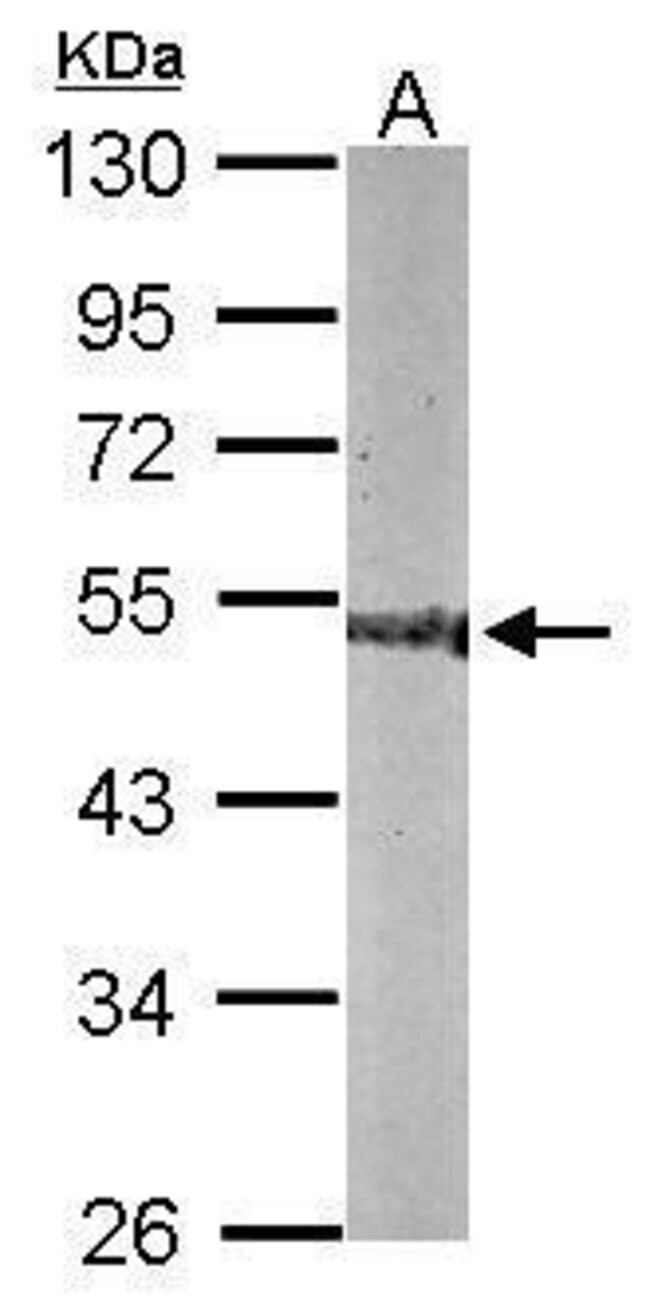 ANTI-CNDP2