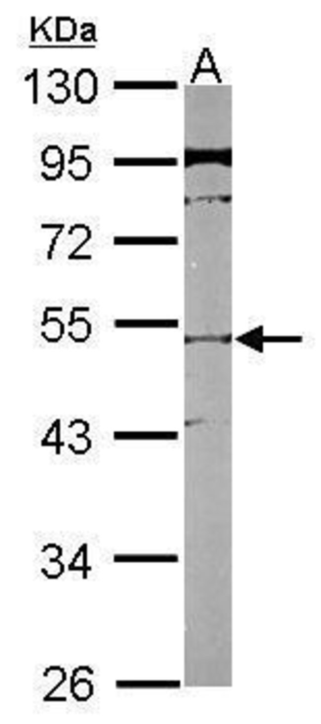 ANTI-SLC25A23