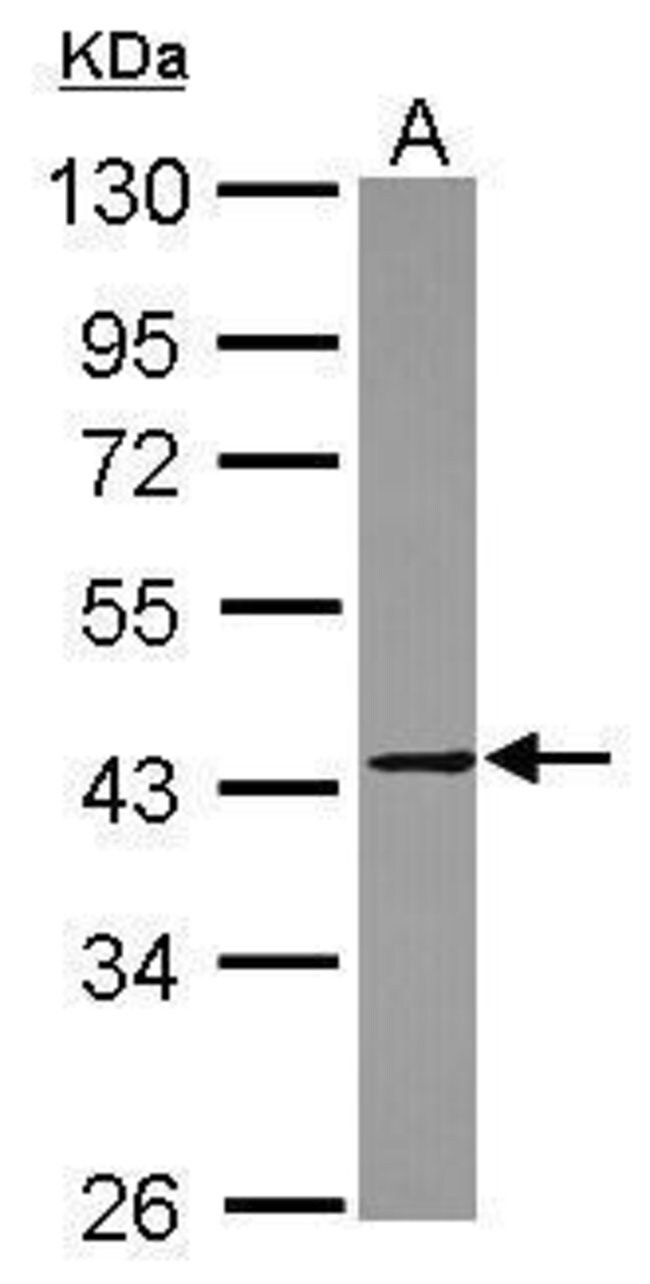 ANTI-MMP23B