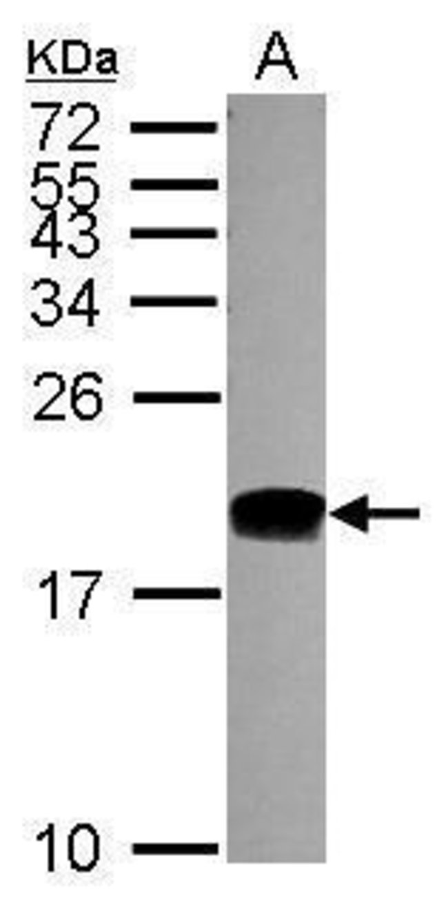 ANTI-DNA POLYMERASE EPSILON