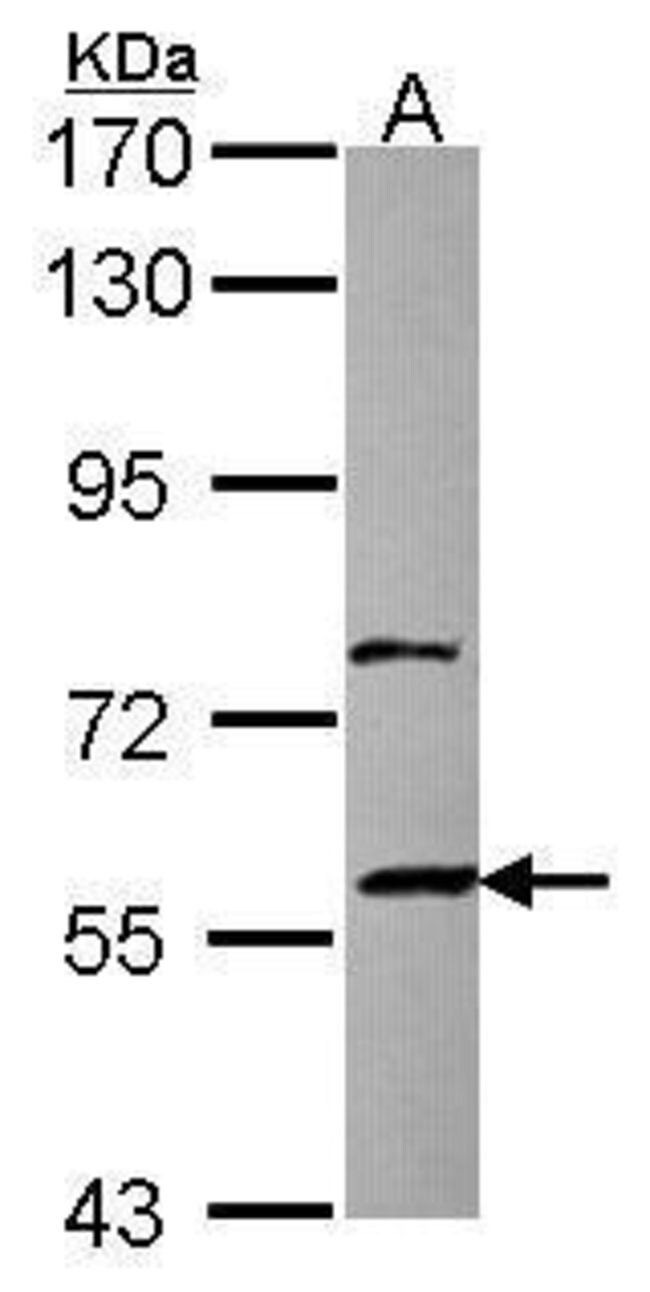 ANTI-ZNF83