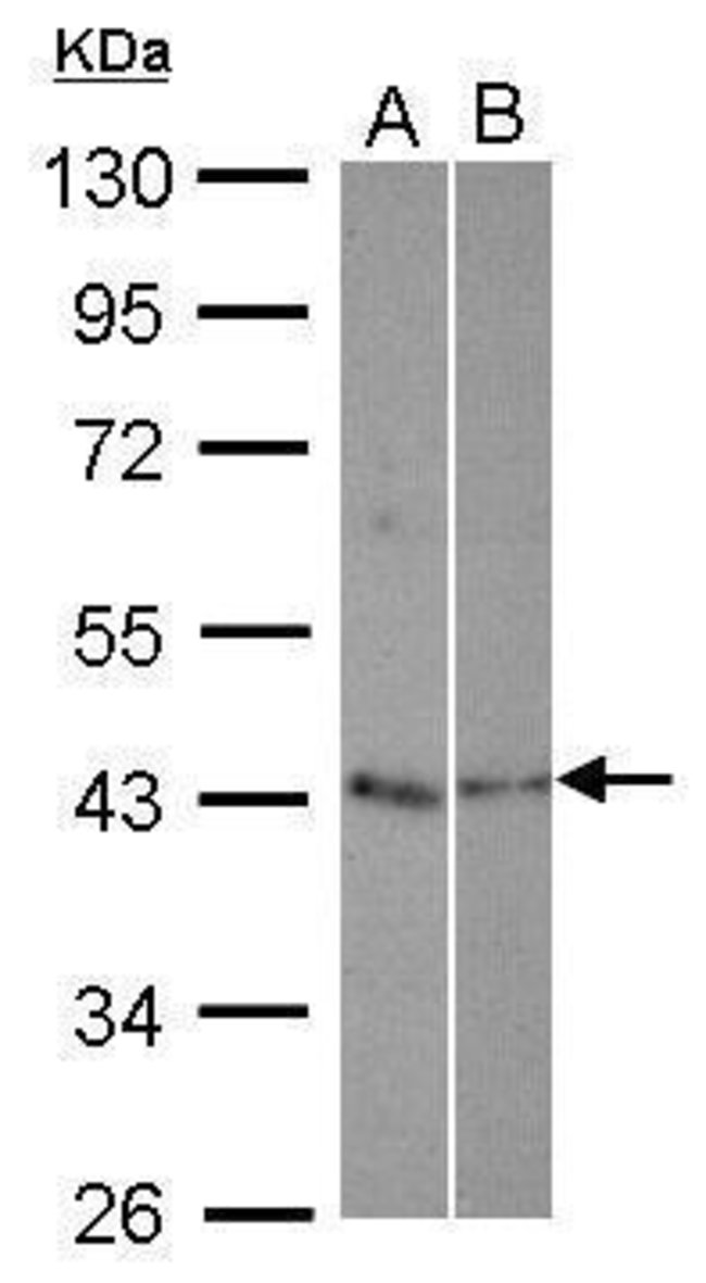 ANTI-TEX13A