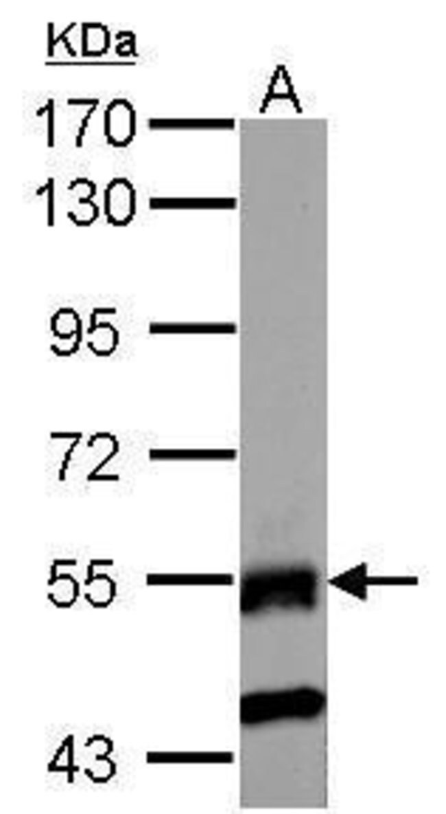 ANTI-RNF23