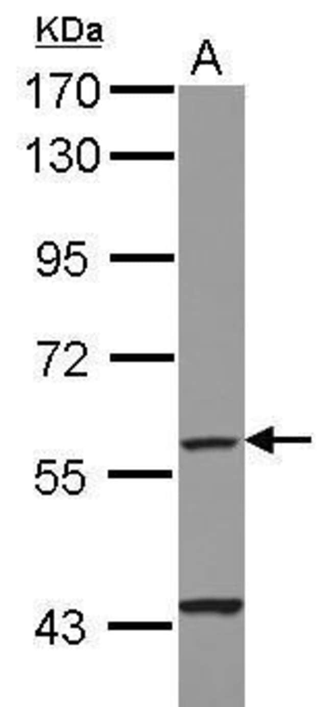 ANTI-CYP4F11