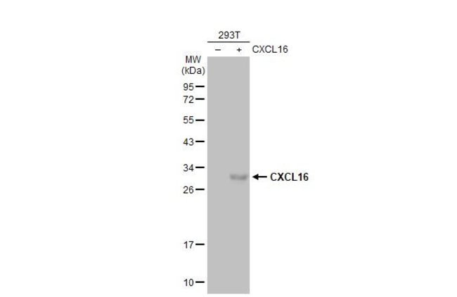 ANTI-CXCL16