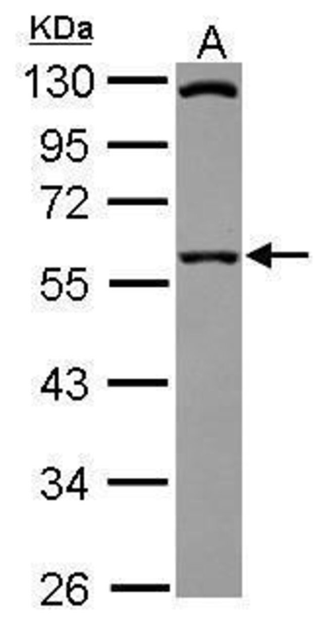 ANTI-SIL1