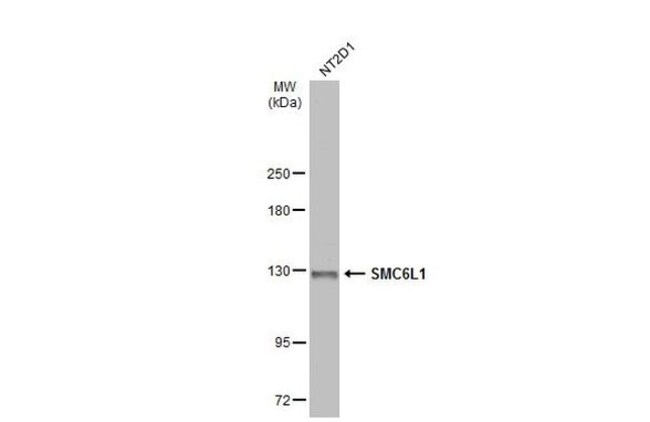 ANTI-SMC6L1