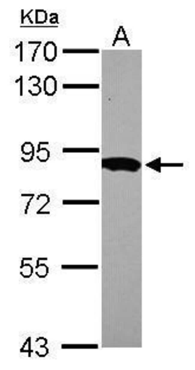 ANTI-HPS6