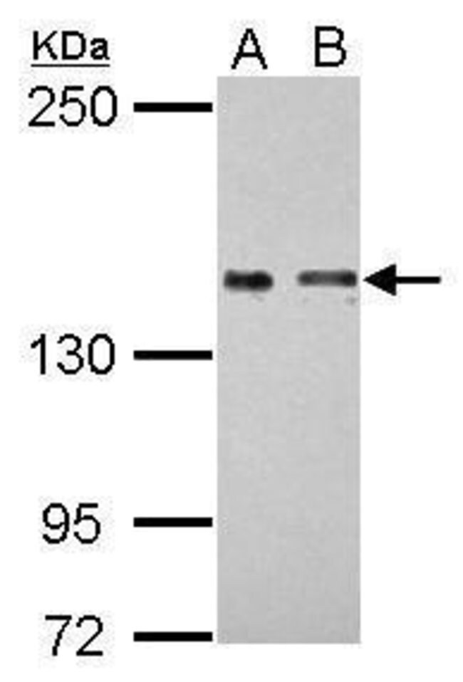 ANTI-COLEC12