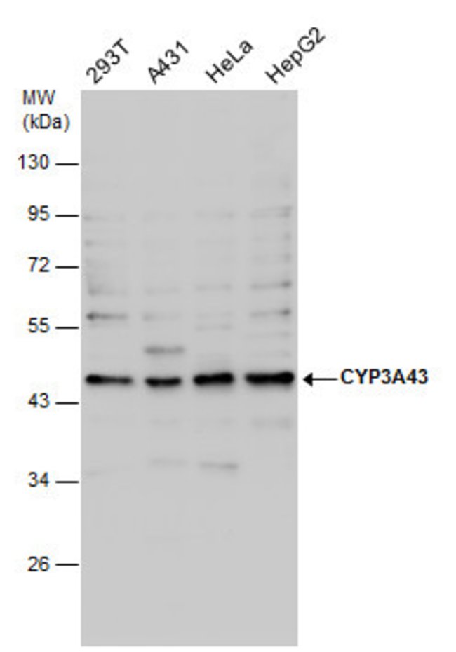 ANTI-CYP3A43