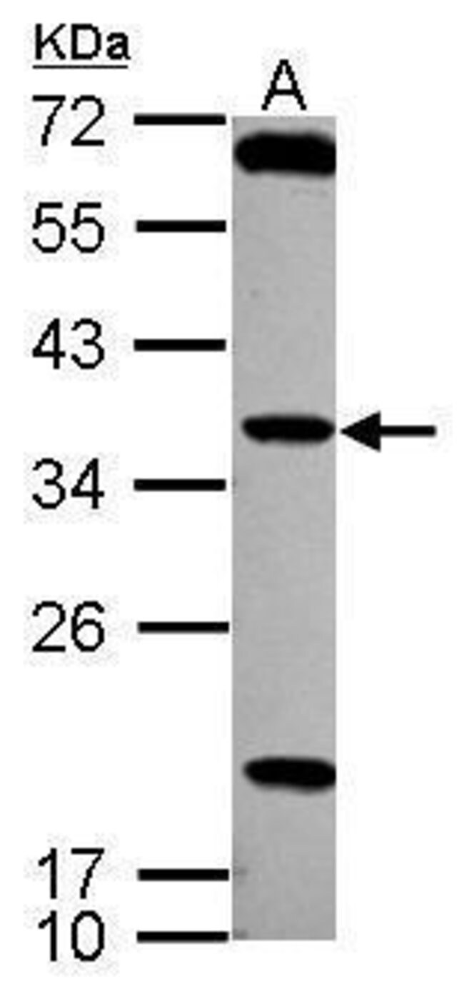 ANTI-TSSK4