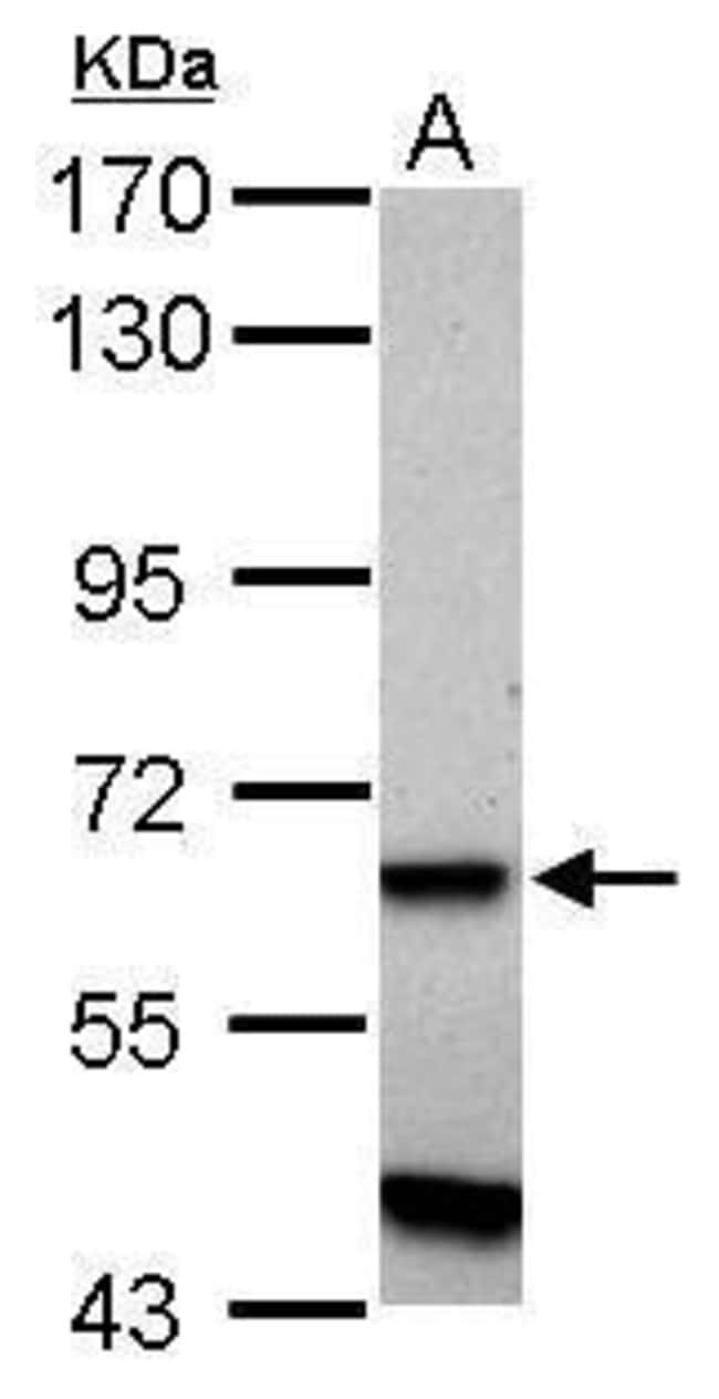 ANTI-ZNF554