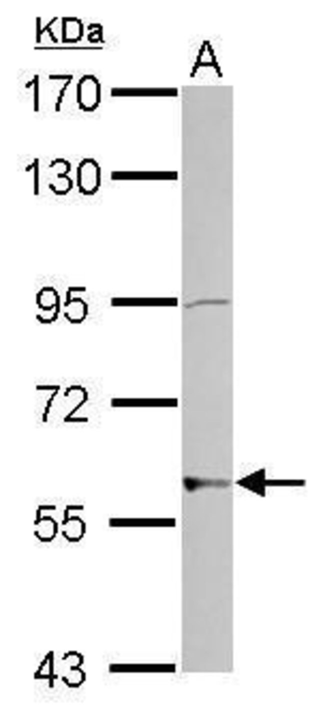 ANTI-ZNF596