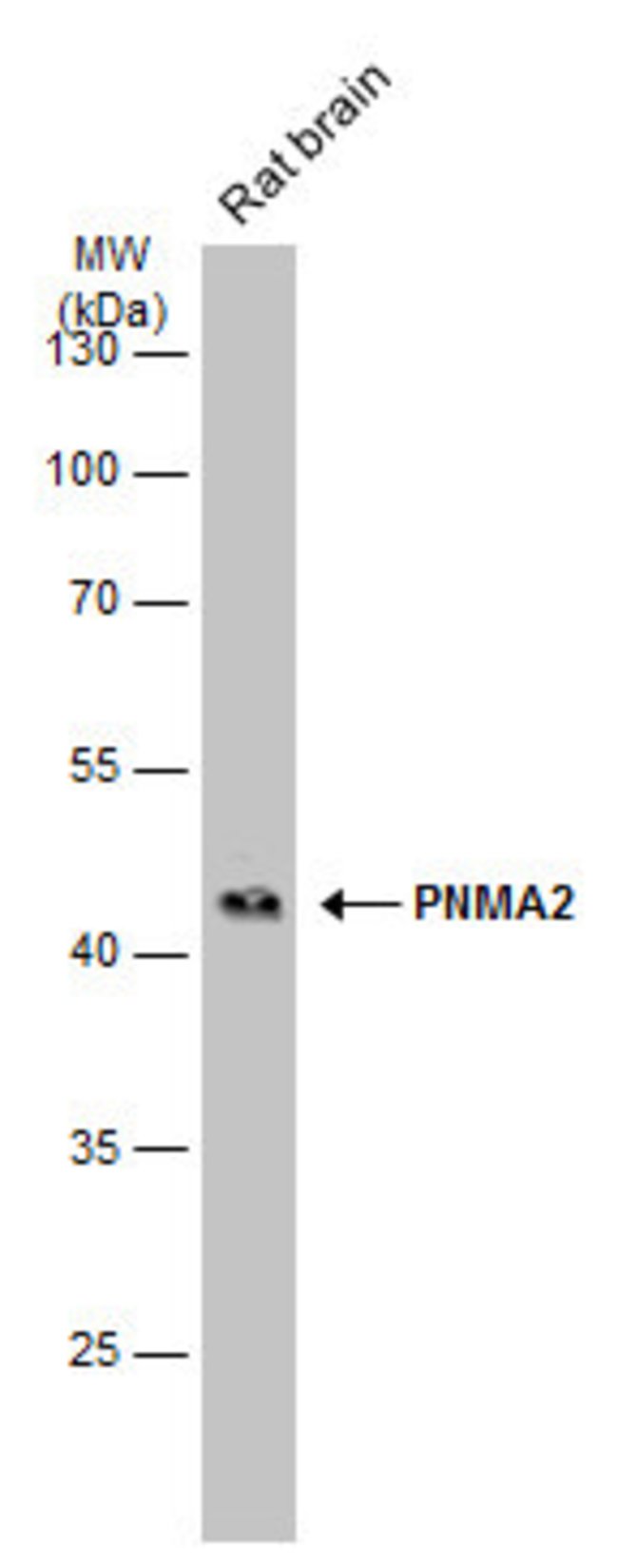 ANTI-PNMA2