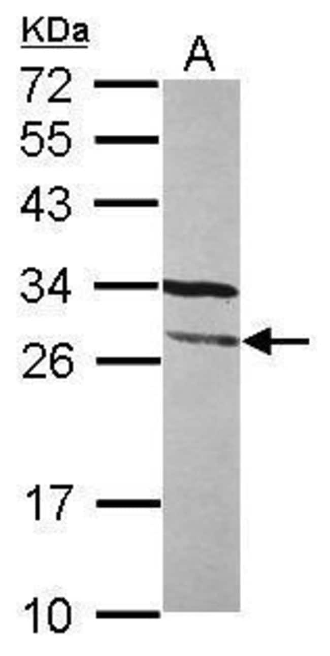 ANTI-FGFR1OP2