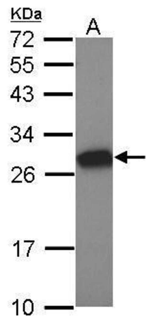 ANTI-TESMIN