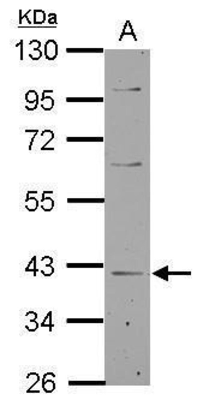 ANTI-LANCL1