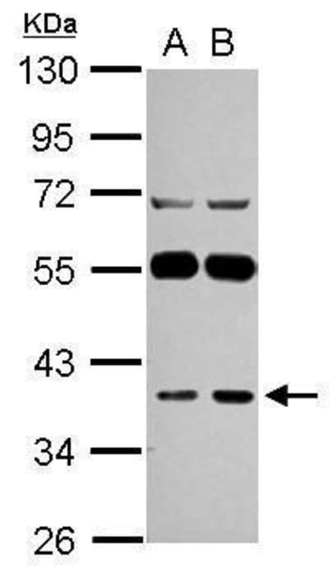 ANTI-LANCL1