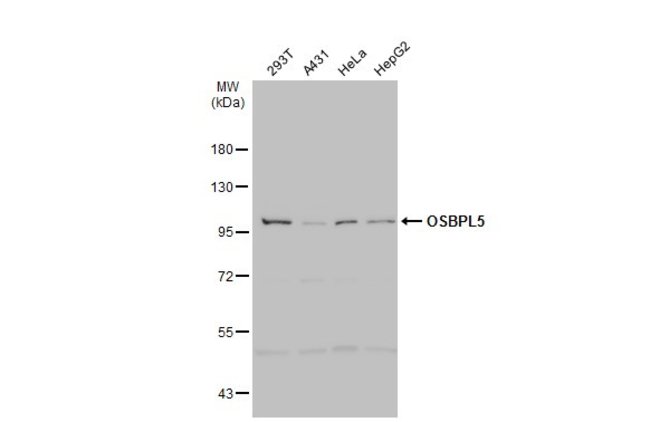 ANTI-OSBPL5