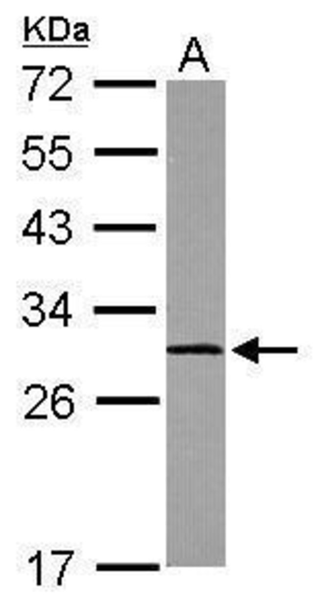 ANTI-CALPAIN S1