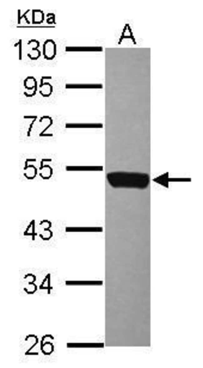 ANTI-CD226