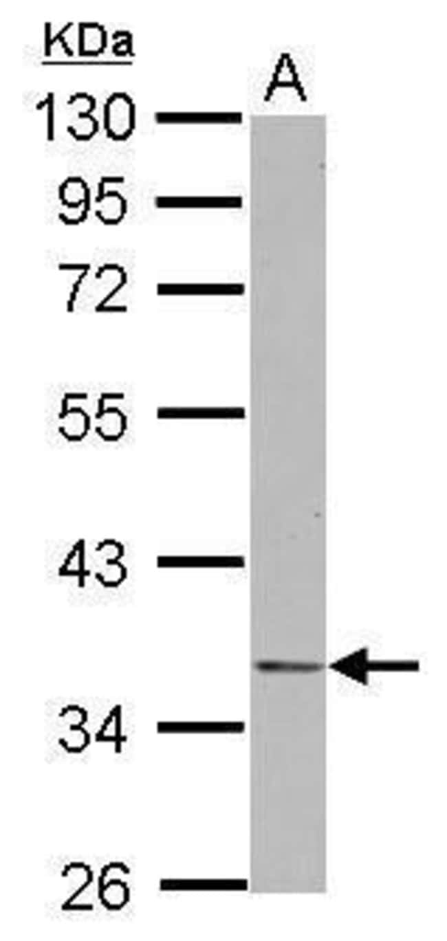 ANTI-NDE1