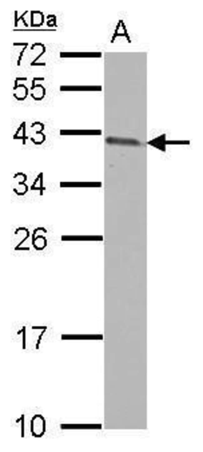 ANTI-ARMC1