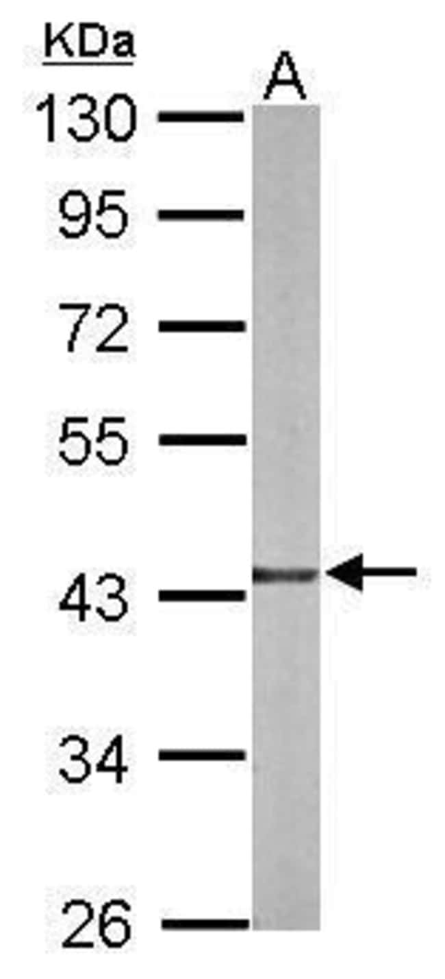 ANTI-TXNL2