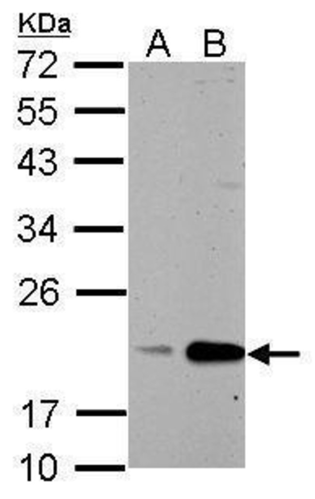 ANTI-CYCLOPHILIN B