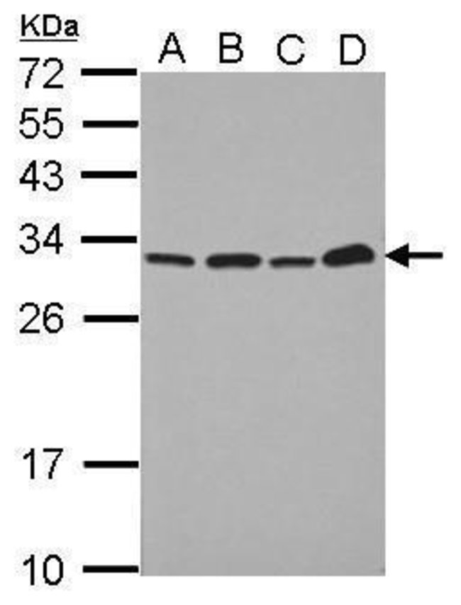 ANTI-PSME1