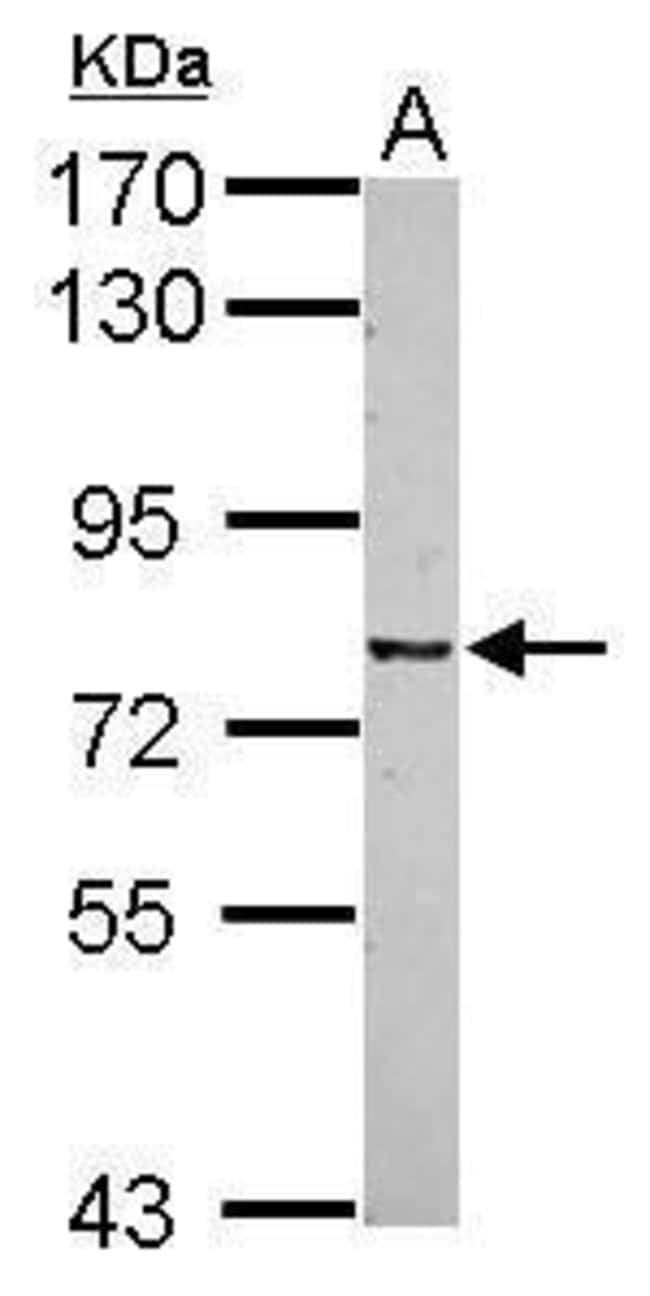 ANTI-CSRP2BP