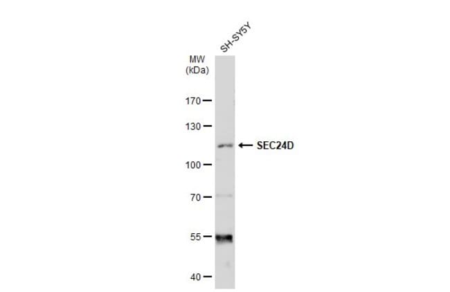 ANTI-SEC24D