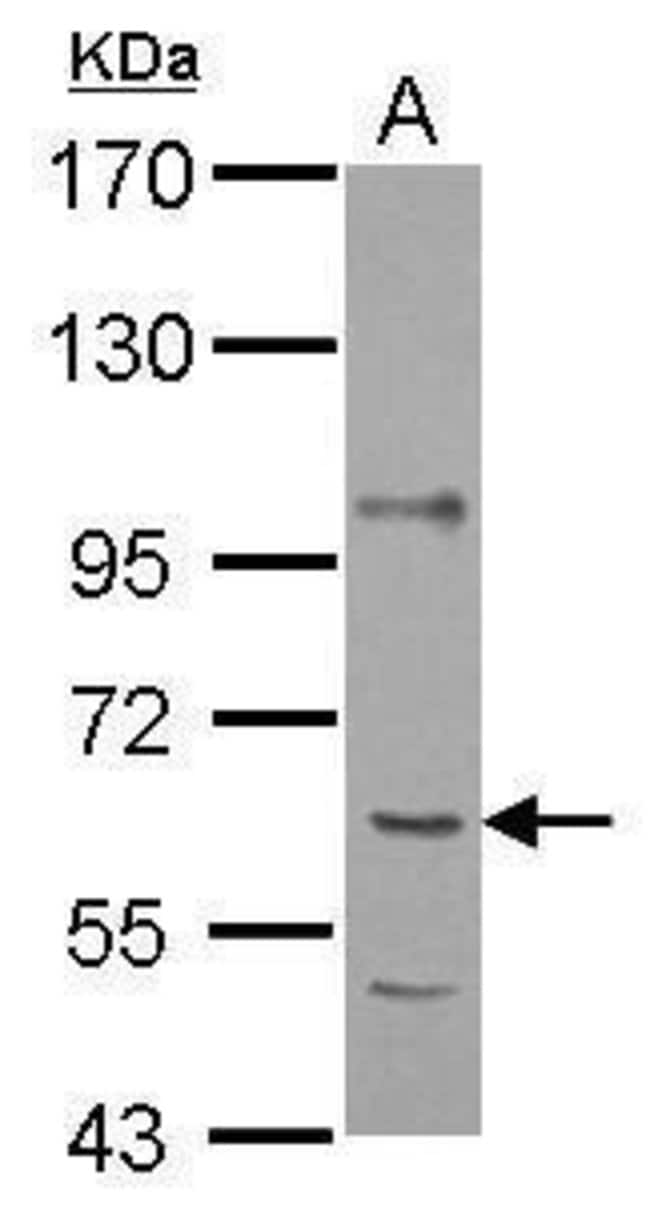 ANTI-P4HA1