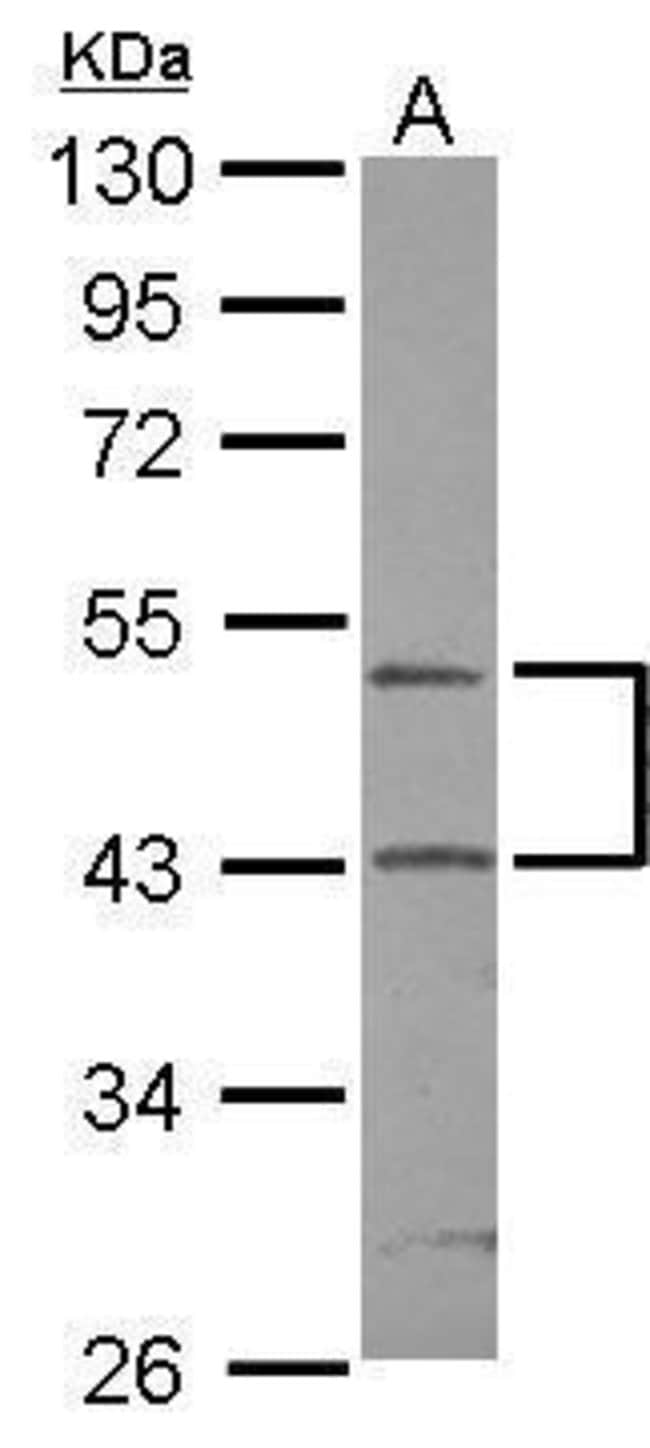 ANTI-RPIP8