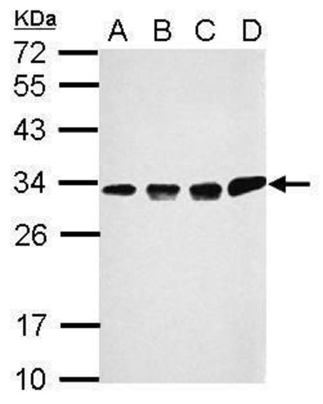 ANTI-CCDC44