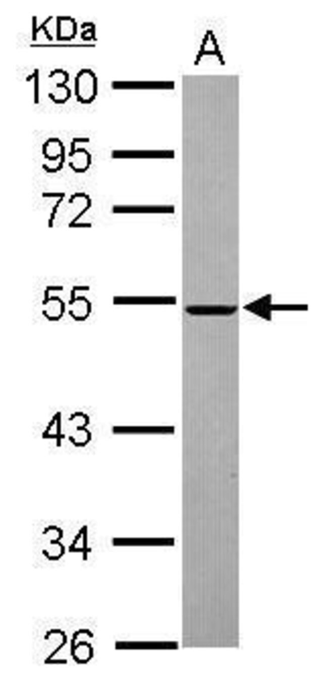 ANTI-MINA53