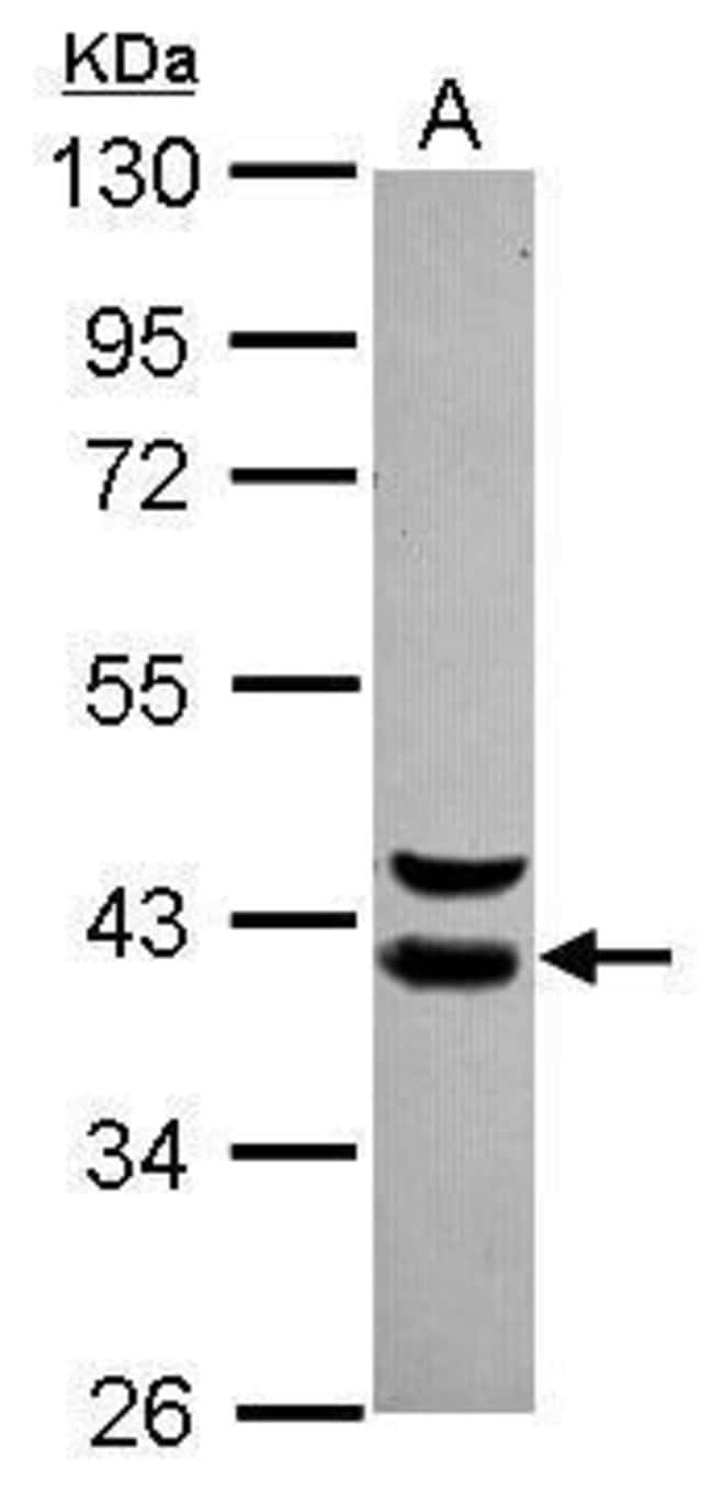 ANTI-WDR74