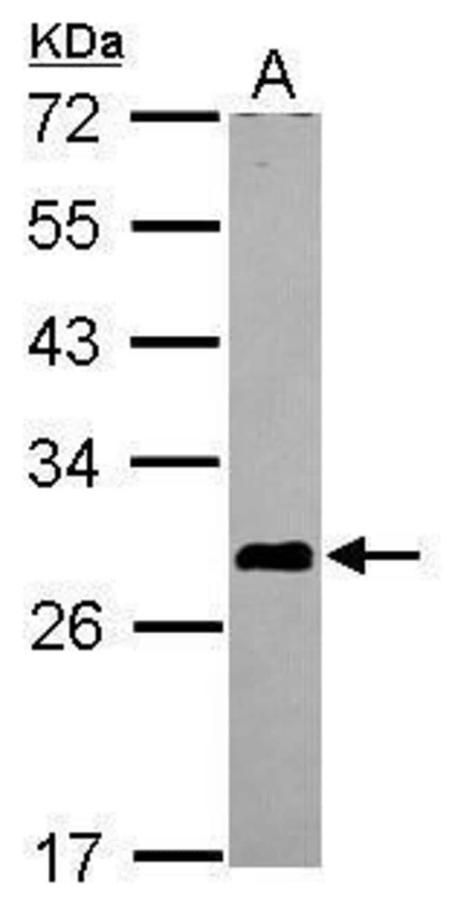 ANTI-ASB7