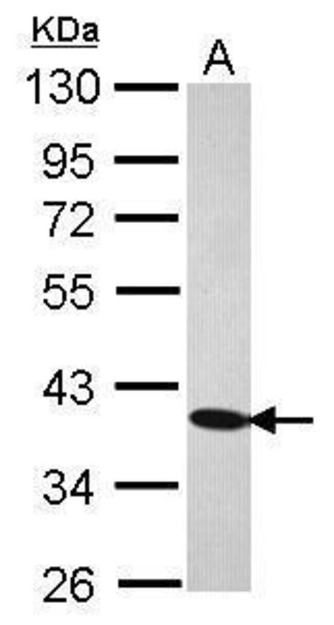 ANTI-C21ORF2