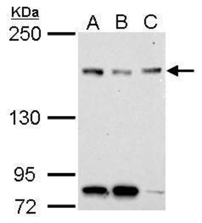 ANTI-NFKBIL2