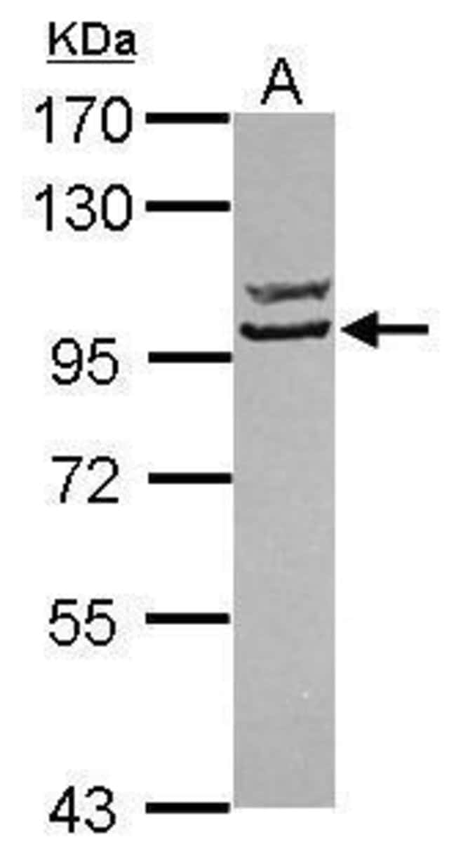 ANTI-STRN3