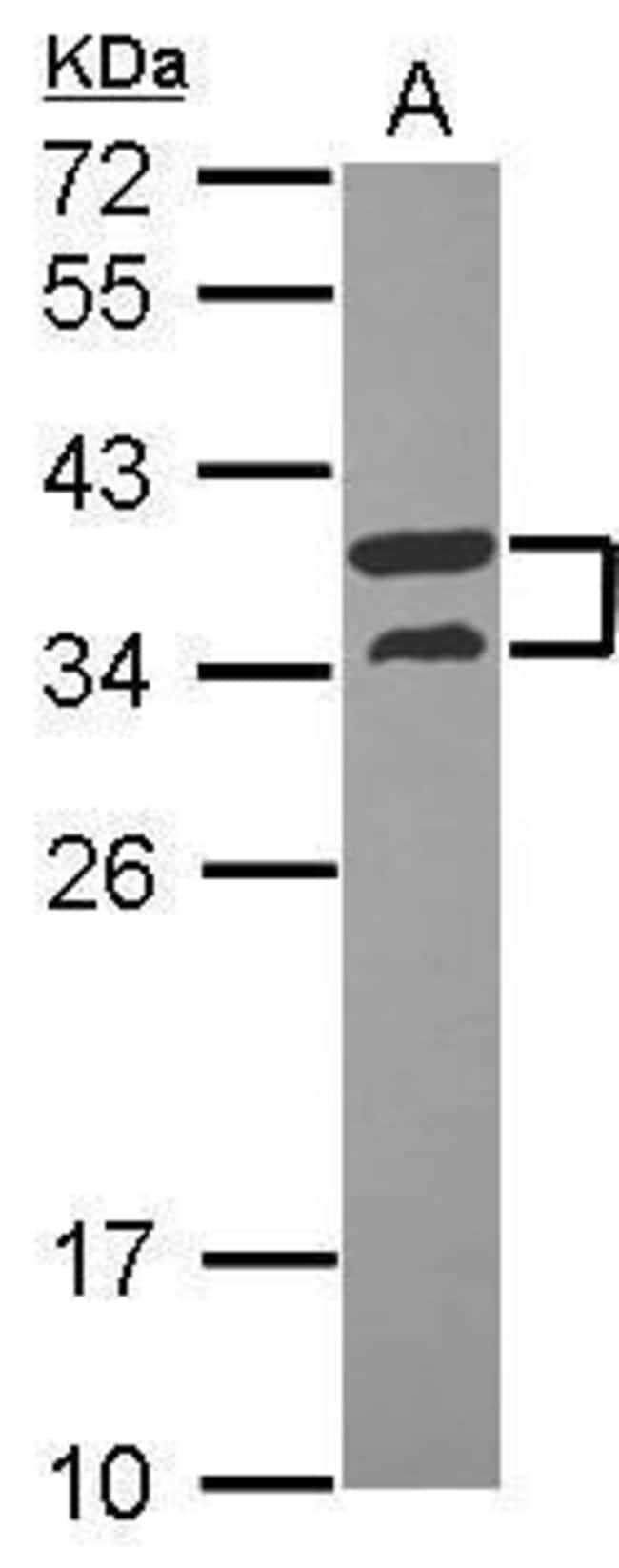 ANTI-V-ATPASE D