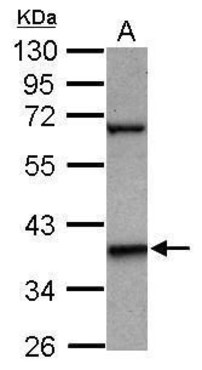 ANTI-LHX5