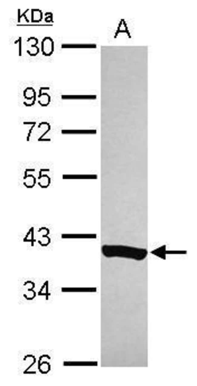 ANTI-C20ORF7