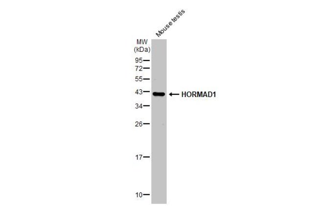 ANTI-HORMAD1