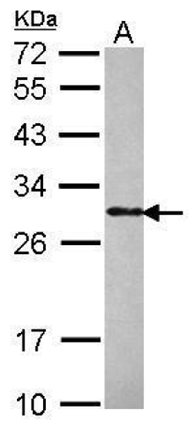 ANTI-PHOSPHO1