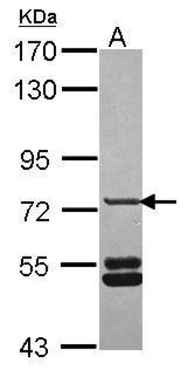 ANTI-SNX33