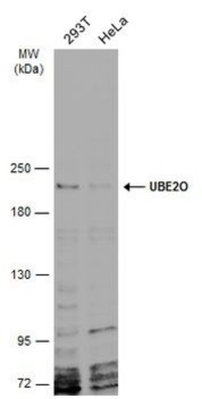 ANTI-UBE2O